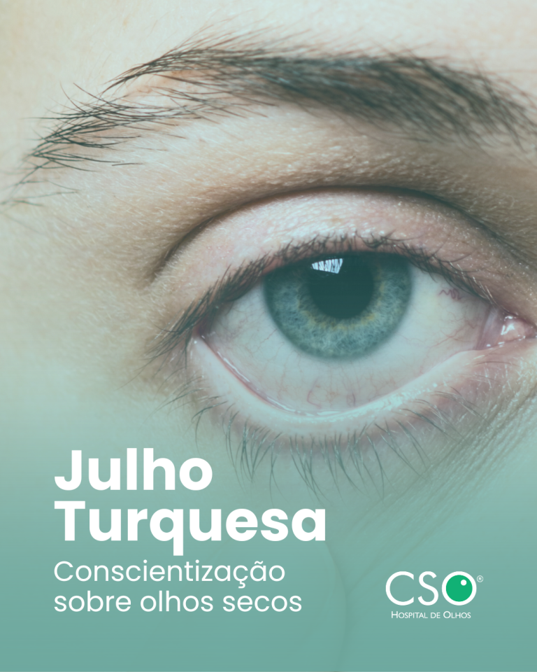 Julho Turquesa: Conscientização sobre olhos secos. Julho é o mês dedicado à conscientização sobre o Olho Seco, uma condição que vai além do simples desconforto.