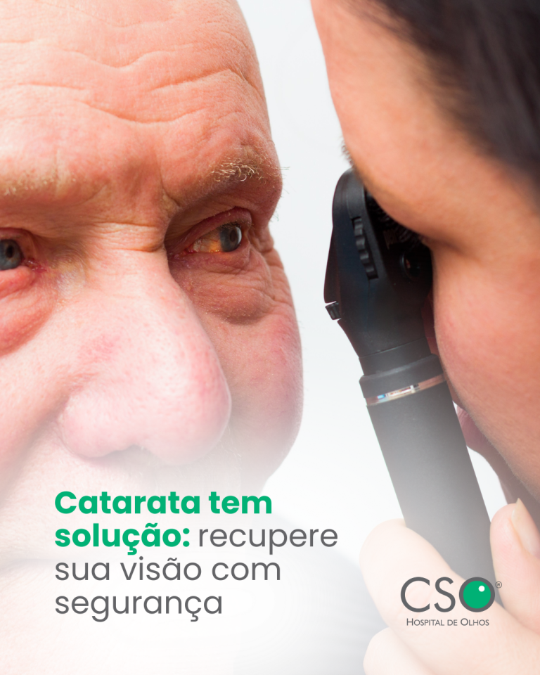 Catarata tem solução: recupere sua visão com segurança A catarata é uma condição comum, especialmente com o avanço da idade, que causa a opacificação do cristalino e leva à visão turva e dificuldade para realizar atividades diárias.
