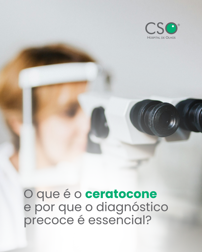 O que é o ceratocone e por que o diagnóstico precoce é essencial? O ceratocone é uma condição ocular progressiva em que a córnea se torna mais fina e assume uma forma irregular, o que leva à visão distorcida e embaçada.