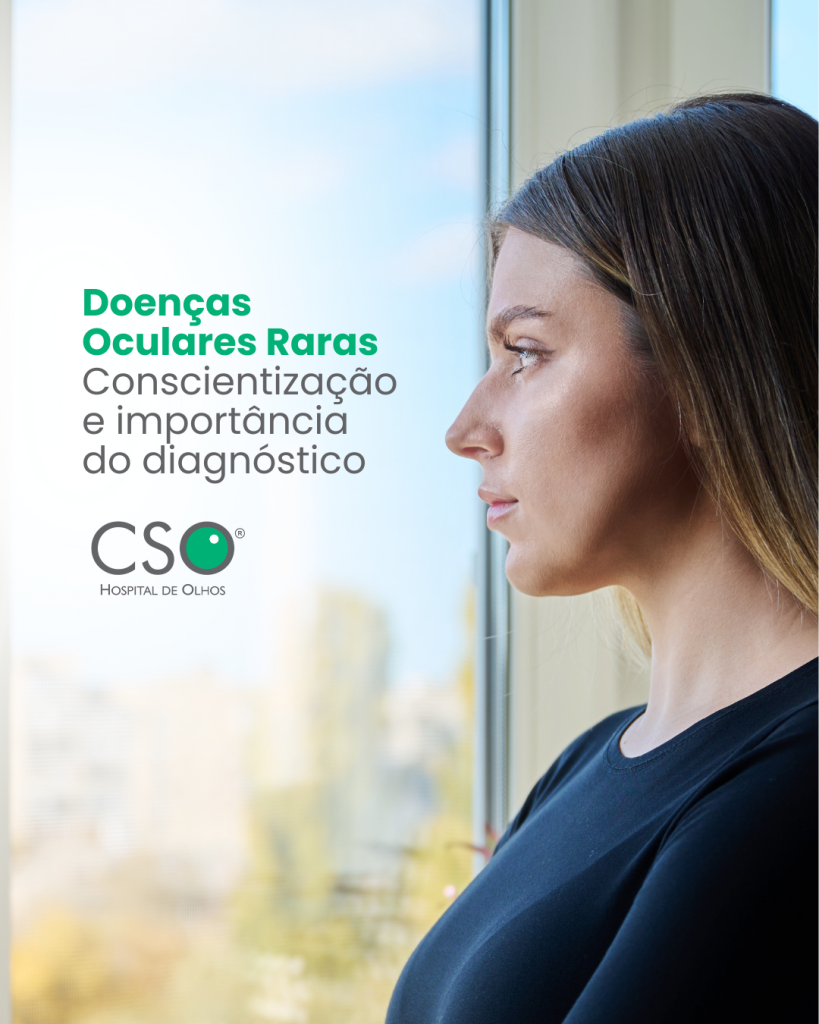 Doenças Oculares Raras -