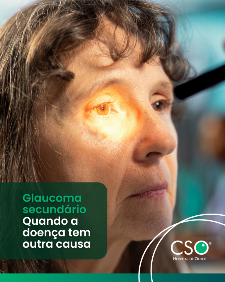 Glaucoma secundário: quando a doença tem outra causa O acompanhamento oftalmológico é essencial não apenas para diagnosticar, mas também para entender a origem do problema.