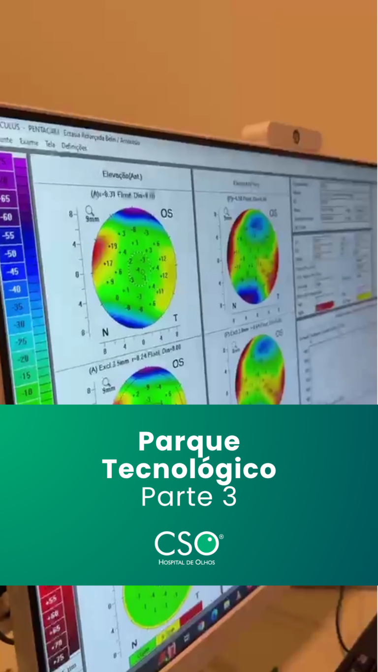 Visita ao Parque Tecnológico CSO Integrar diagnóstico criterioso e planejamento cirúrgico estruturado é parte do compromisso do CSO com o cuidado oftalmológico responsável e seguro.