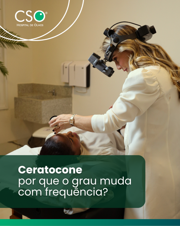 Ceratocone: por que o grau muda com frequência? Uma das características mais comuns do ceratocone é a alteração frequente do grau dos óculos.