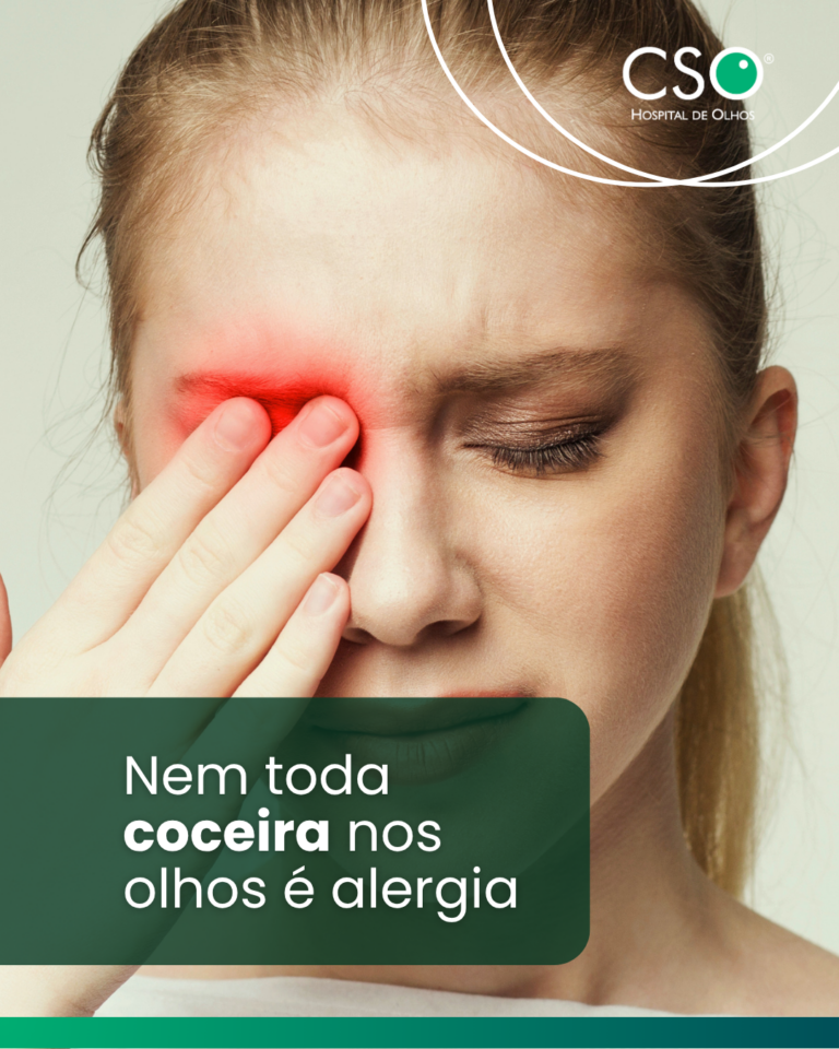 Nem toda coceira nos olhos é alergia. Quando os olhos começam a coçar, muitas pessoas associam imediatamente o sintoma a uma alergia.