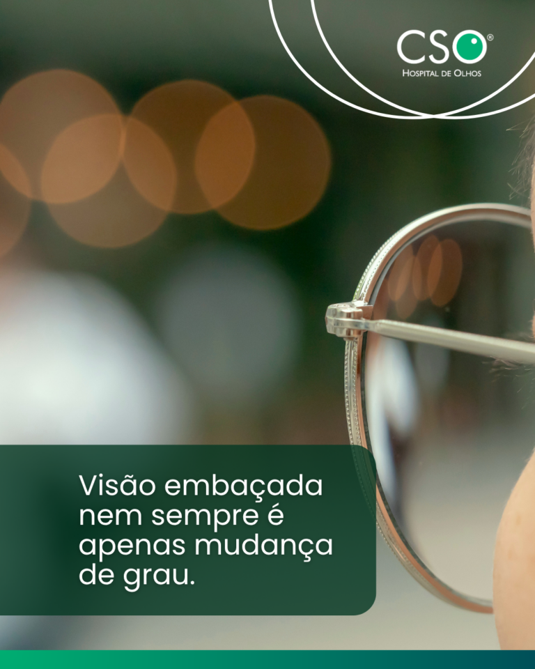 Visão embaçada nem sempre é apenas mudança de grau Quando a visão começa a ficar embaçada, é comum pensar que basta trocar os óculos.