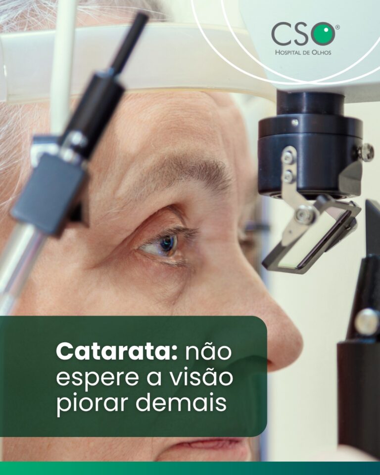 Catarata: não espere a visão piorar demais Com diagnóstico adequado e indicação médica, a cirurgia de catarata é capaz de substituir o cristalino